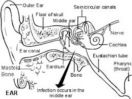 lesson 13 common ent problems wikieducator