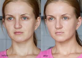 08 ($40.08/fl oz) get it as soon as fri, jan 29. Produkte Im Test Clinique Even Better Spf15 Fotografin Fotostudio