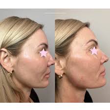 Stefani Neumann, MSN, FNP-C (@stefanineumann.np) • Instagram photos and  videos