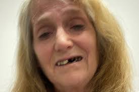 Fundraiser by Cynthia Rowe : Support Cynthia Gord Rowe family -schleroderma