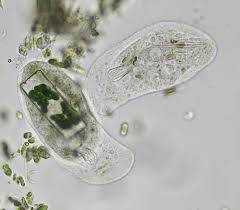 Pick off an entire healthy looking elodea leaf, with fingers or small scissors and place it on the microscope slide. Bresser Hay Infusion Expand Your Horizon