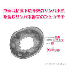 虫垂は粘膜下に多数のリンパ小節を含むリンパ系器官のひとつである 解答 虫垂は粘膜下に多数のリンパ小節を含むことから リンパ系器官のひとつとして考えられます 解剖学 消化器系 大腸 虫垂 appendix リンパ小節 lymph nodule 一問一