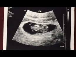 We did not find results for: 8 Weeks 2 Days Due Date Rheingau Com