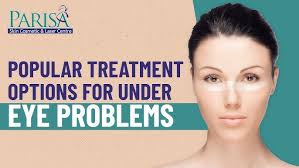 Popular Treatment Options For Under Eye Problems
