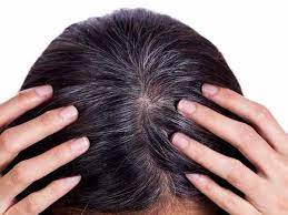 Once your hair follicles lose melanin, they can't produce it on their own. Home Remedies To Get Rid Of White Hair Easily Boldsky Com