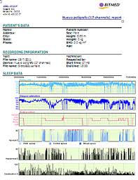 The Online Sleep Clinic Testing At Home