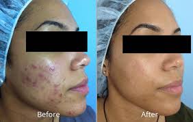 Advanced dermatology & cosmetic surgery. Facial Services Sugar Salon Medical Spa