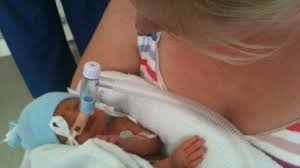 Generally, the earlier a baby is born, the higher the risk of complications. Petition Extend Parental Leave For Parents Of Premature Babies Change Org