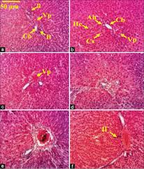 Image result for Markhamia tomentosa