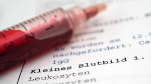 Was Die Abkurzungen Beim Blutbild Bedeuten Gesundheit
