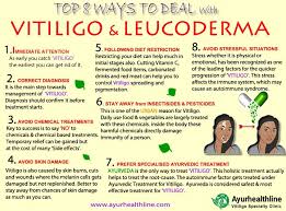 Ayurhealthline On Twitter Top 8 Ways To Deal With Vitiligo Leucoderma Get Expert Advise On Https T Co Wkycnvucyo To Know About Customized Ayurvedic Treatment For Vitiligo Chat Https T Co Nw5614vag5 Vitiligo Vitiligoawareness Leucoderma