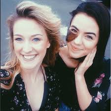 Isn't she beautiful? This dancer loves her hairy birth mark and is an  inspiration