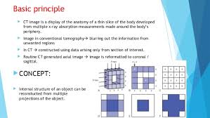 Multislice Ct Scan Ppt Ct Scan Machine