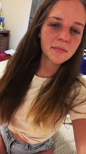 Alicia Hagerman's Instagram, Twitter & Facebook