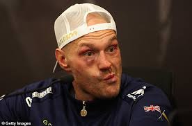 Tyson Fury vs Oleksandr Usyk