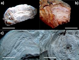 Structural Elucidation Of Silica Present In Kidney Stones Coming From Burkina Faso Sciencedirect