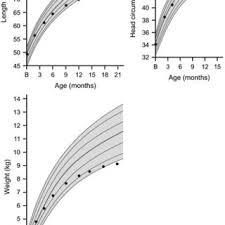 Severe Growth Hormone Deficiency Ghd If Weight And Height