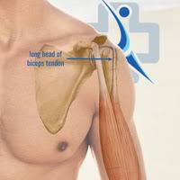 Image result for Biceps Tendon Injection