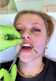 Got her smiley piercing to match her vibe! 😬✨Who else is obsessed with  this look? #SmileyPiercingGoals #PiercingPerfection #FeelingSmiley  #SmileyPiercing #PiercingStyle #PiercingAddict #BodyPiercing ...