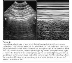 Apa itu nisn dan npsn? Clinical Ultrasound In The Age Of Artificial Intelligence Healthmanagement Org