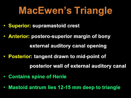This is the area of dural openning bounded by the superior petrosal sinus, the sigmoid sinus and the bone labyrinth. Anatomy Of Ear Mastoid Ppt Video Online Download