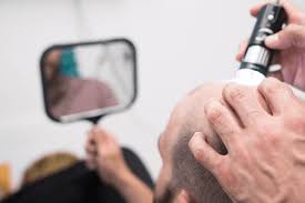 Unfortunately, rogaine (minoxidil) usage is almost always associated with an initial shedding phase. during this shedding phase, which can last up to 4 months, users experience excessive, accelerated periods of hair loss, and feel like the medication is causing them to go bald even quicker. Why Rogaine Is Stopping You From Growing Your Hair Back