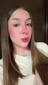 Misol Arambula Y Su Hermana