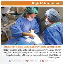 Dogustan Olan Ust Goz Kapagi Dusukluklerini Frontale Asma Dedigimiz Ameliyat Teknigi Ile Tedavi Ediyoruz Bu Teknikte Ust Kapagin Icinden Si Teknik Bilgi Ust