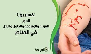 Maybe you would like to learn more about one of these? ØªÙØ³ÙŠØ± Ø­Ù„Ù… Ø§Ù„Ø¯Ù… Ù„Ù„Ø¹Ø²Ø¨Ø§Ø¡ Ùˆ Ø§Ù„Ù…ØªØ²ÙˆØ¬Ø© Ùˆ Ø§Ù„Ø­Ø§Ù…Ù„ Ùˆ Ø§Ù„Ù…Ø·Ù„Ù‚Ø© Ùˆ Ø§Ù„Ø±Ø¬Ù„ Ø§Ø±Ø¨ Ø­Ø¸