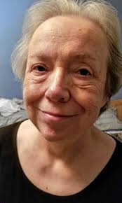 With nowhere to go as care ends, patients extend stays in Upper Valley  hospitals