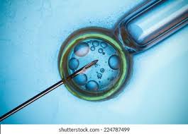 In Vitro Fertilization High Res Stock Images Shutterstock