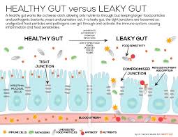 Vincent pedre, md ifmcp dr. Upgradethealpha Upgradethealpha Twitter