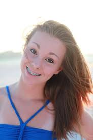 For one who works full time and paid braces out of pocket, it was the most affordable option!! I Make Braces Look Good By Photouge On Deviantart