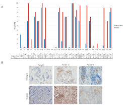 • access to all ln stations accessible by med as well as n1 nodes. Cancers Free Full Text Ebus Tbna Cytological Samples For Comprehensive Molecular Testing In Non Small Cell Lung Cancer Html