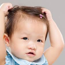 Inilah 6 Penyebab Rambut Anak Susah Tumbuh
