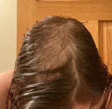 Remove it from heat and let it cool for few minutes. Finally Seeing Regrowth After A Very Bad Pulling Session My Hair Stylist Recommended Putting Olive Oil On My Hair During A Pull Session To Stop The Grip Feeling Hair Texture And You Guys