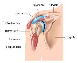 Bursitis of the shoulder (impingement syndrome) occurs when there is swelling and redness between the top of the arm bone and the tip of the shoulder. Shoulder Bursitis Impingement Treatment Recovery Time