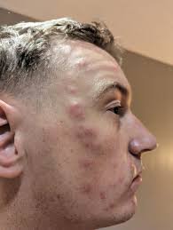 Heather Mandt Sailer and I survived the jellies at the practice swim! I was  super panicked but made it out just fine. Phew, glad we aren't allergic!