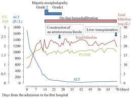 Chart Showing The Course Of Alt Pt Inr And Total Bilirubin