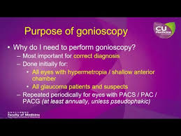 Image result for Gonioscopy