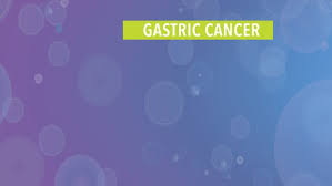 Metastatic disease (also known as stage 4) is usually not curable by todays treatments. Treatment Of Stage Iv Metastatic Or Recurrent Colon Cancer Cancerconnect