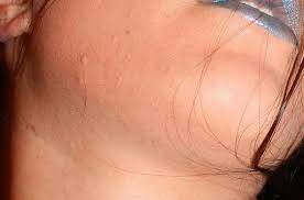 Pin On Remedies