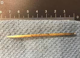 Check spelling or type a new query. My Dog Swallowed A Toothpick What Should I Do Our Fit Pets