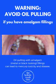 Pin On Teeth Mouth