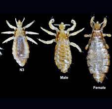 Auf den ersten blick können nissen aussehen wie schuppen. Zunehmender Befall Verbreiten Sich Kopflause Durch Selfies Welt