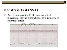 Welcome to the network security toolkit (nst). Antepartum Testing