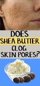 Does Shea Butter Clog Skin Pores Shea Butter Recipes Shea Butter Benefits Skincare Shea Butter Benefits