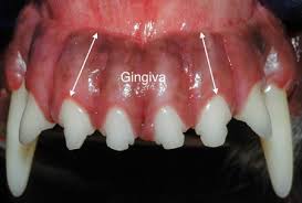 Image result for Gingiva