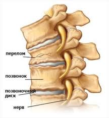 что находится с левой стороны под ребрами у человека Boli V Grudnom Otdele Pozvonochnika I Zhzhenie Mezhdu Lopatkami Prichiny Diagnostika Lechenie V Kieve