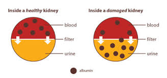 Learn About Kidney Disease Veterans Health Administration